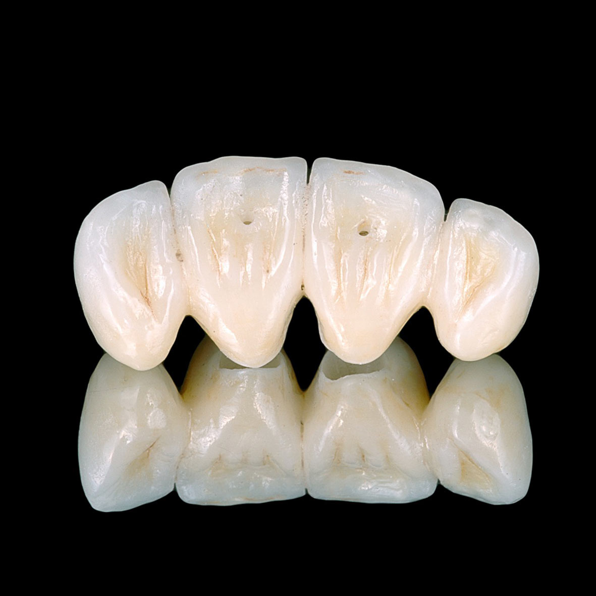 modelos-coronas-dentales