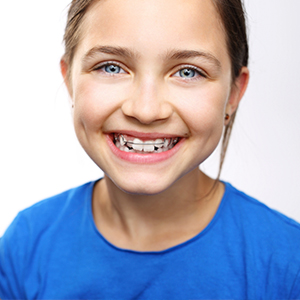 ortodoncia-niños-donostia