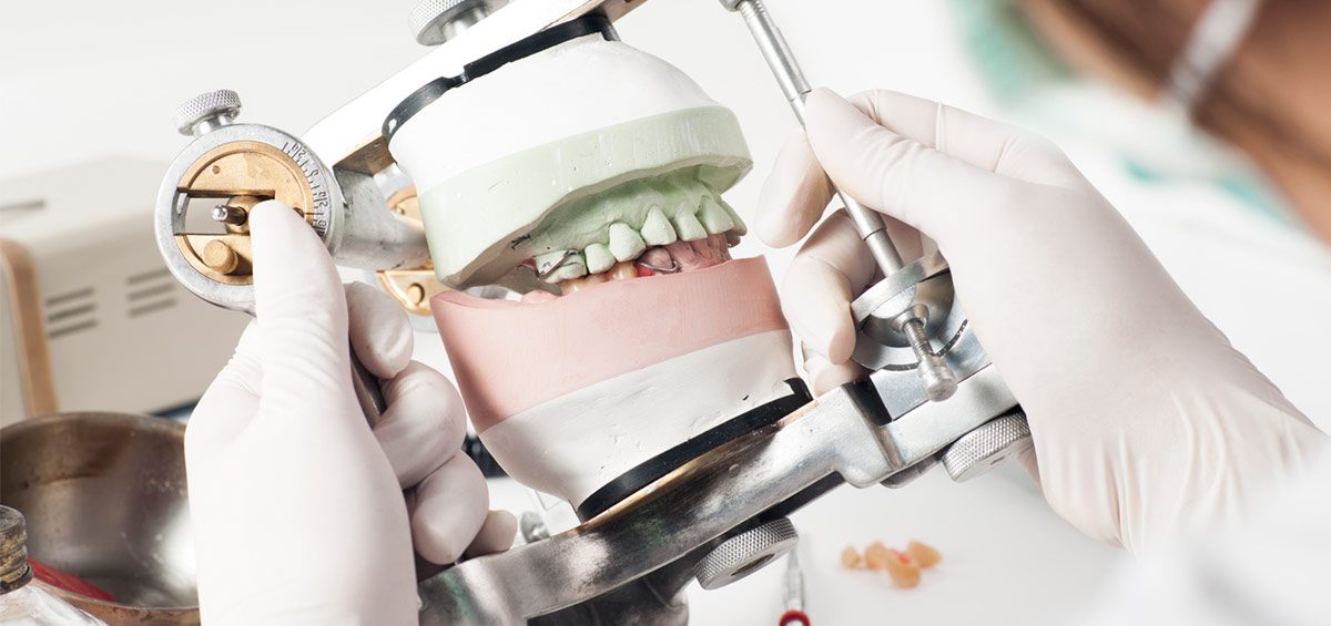 ¿Cuál es la diferencia entre las prótesis y los implantes dentales?